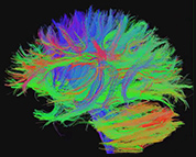 Foto referente ao curso de Neurociências